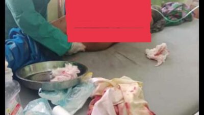 Kakek Nelayan Sungkur Udang Terasi Diserang Buaya di Perairan Mempunai, Bangka Selatan